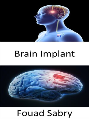 cover image of Brain Implant